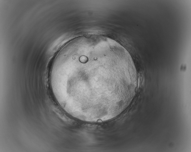 X0000111600339200908061419