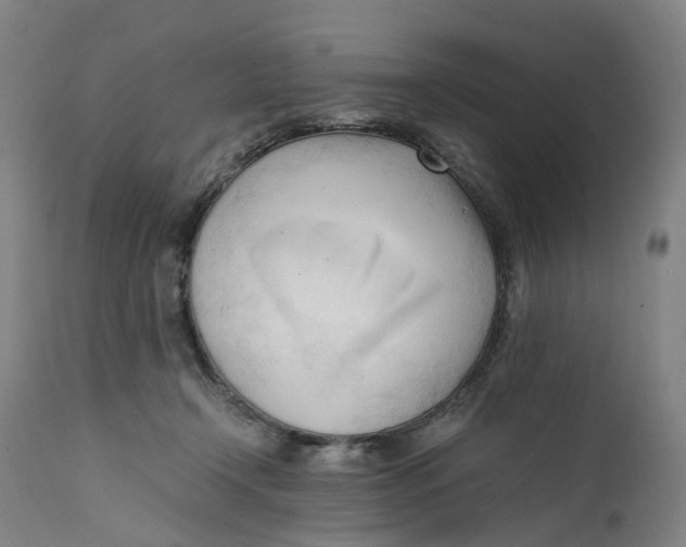 X0000111600366200908061419
