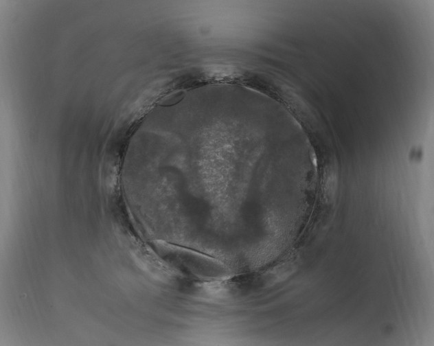 X0000111600417200908061419