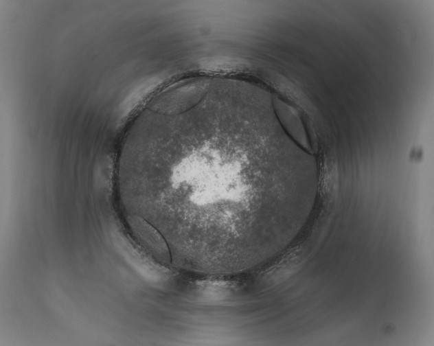 X0000111600448200908061418