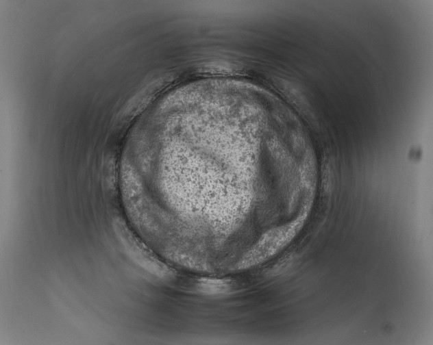 X0000111600457200908061418