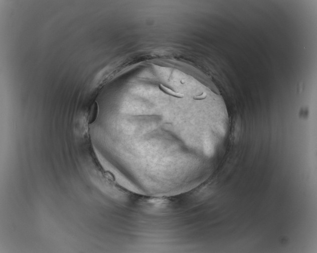 X0000111600478200908061418