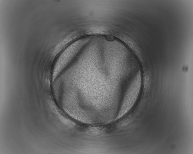 X0000111600489200908061418