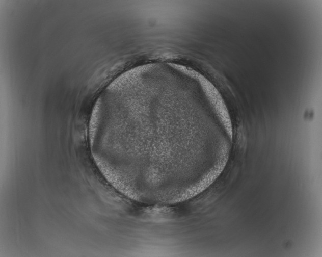 X0000111600517200908061417