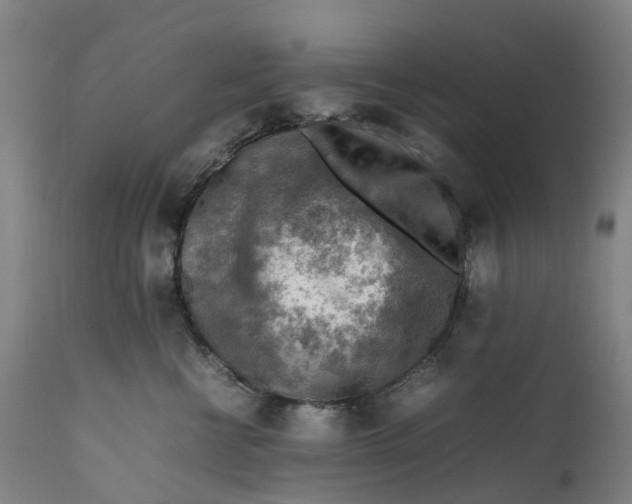 X0000111600570200908061417