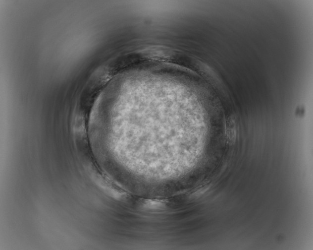 X0000111600573200908061417