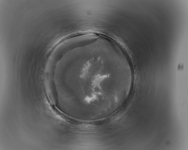 X0000111600577200908061416