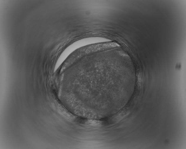 X0000111600617200908061415