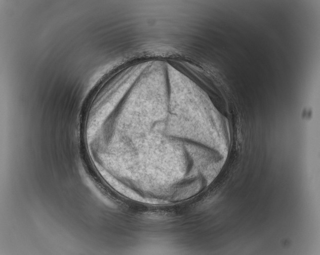 X0000111600630200908061415