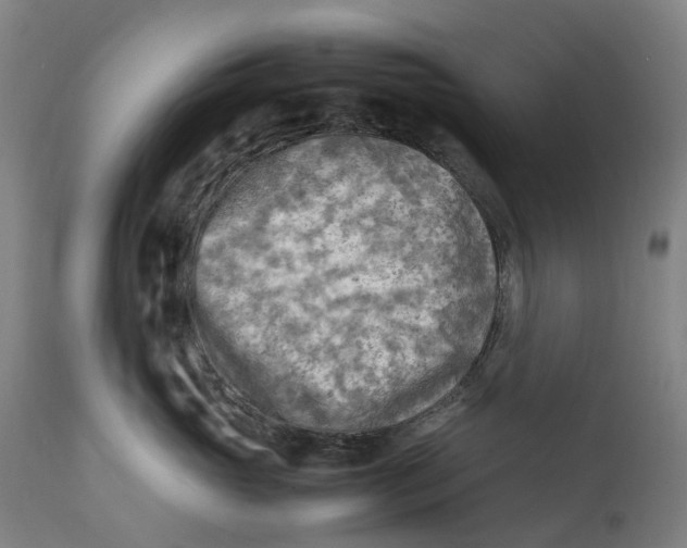 X0000111600765200908061414