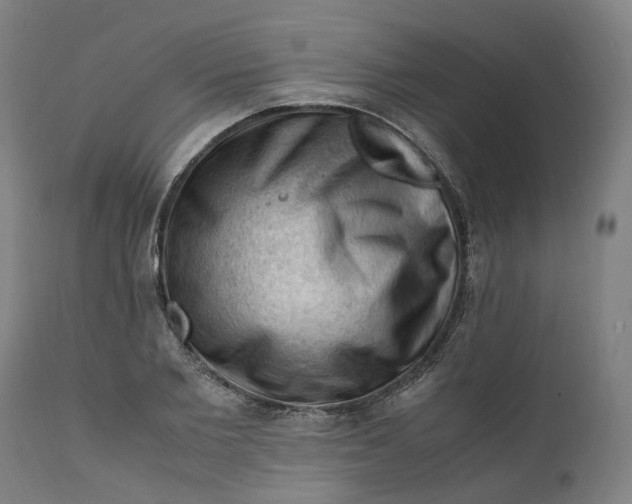 X0000111600885200908061411