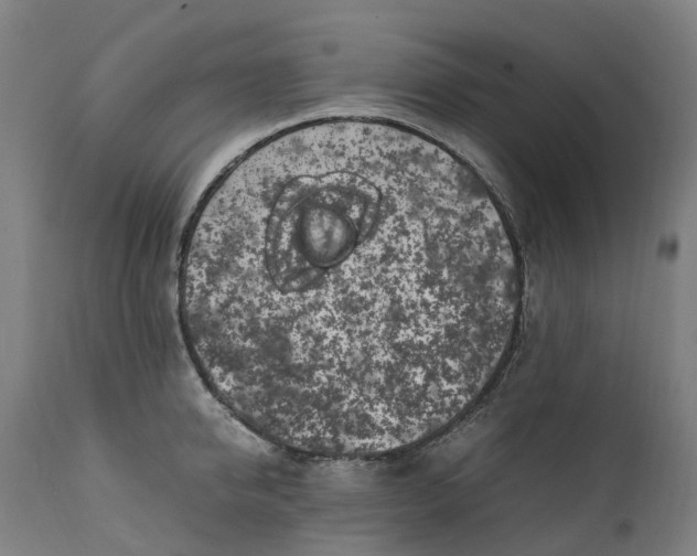 X0000111600950200908061411