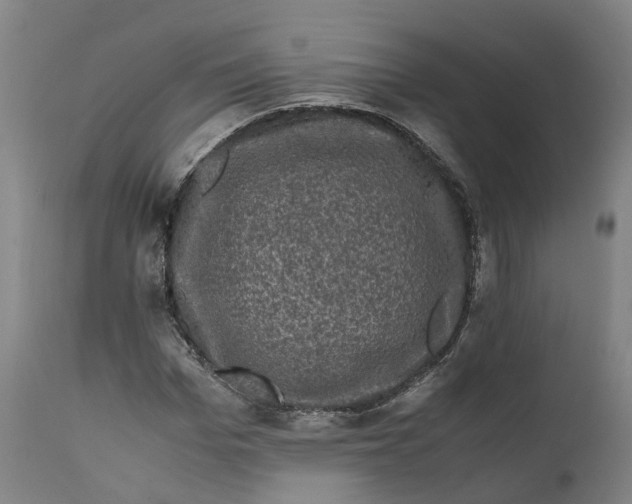 X0000111600969200908061410