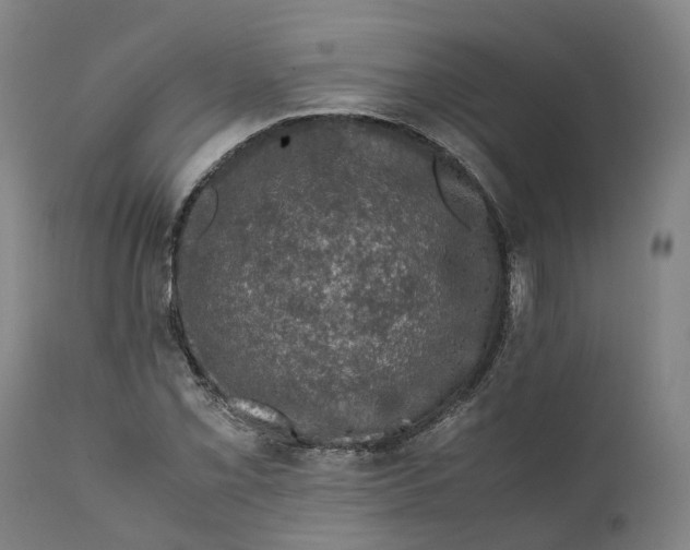 X0000111601069200908061408
