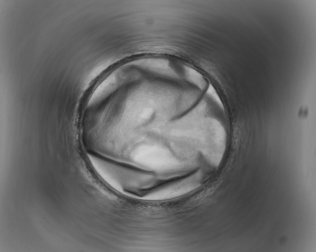 X0000111601071200908061408