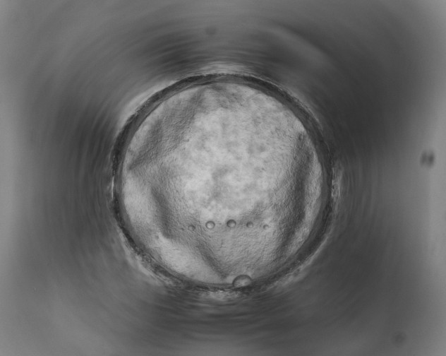 X0000111601117200908061407