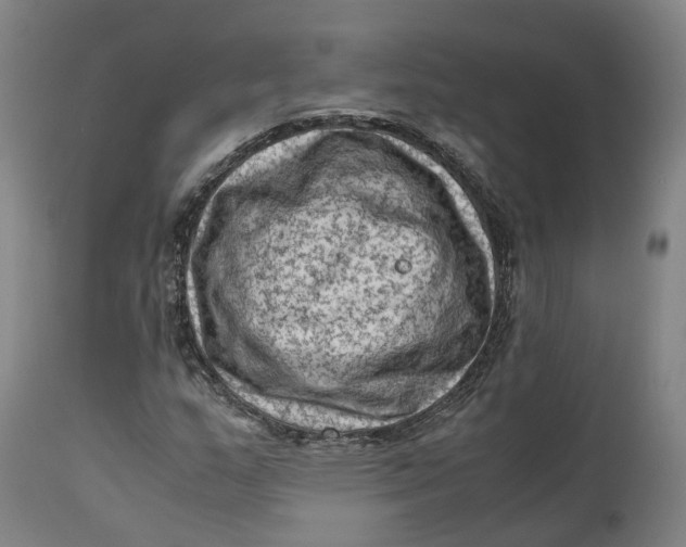X0000111601159200908061407