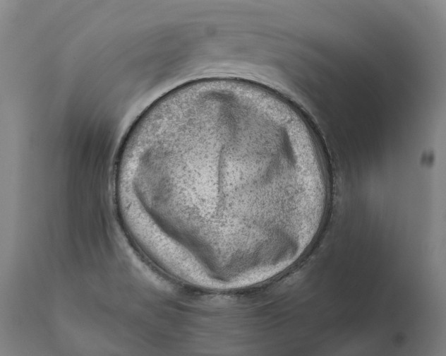 X0000111601517200908061402