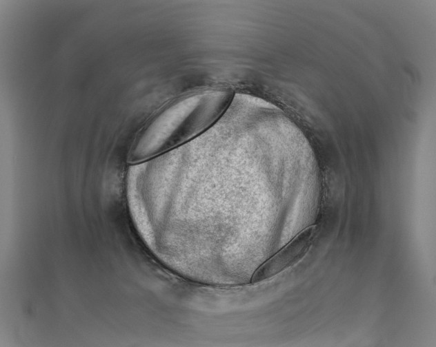 X0000111600033200908131413