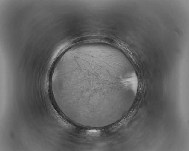 X0000111600053200908131412