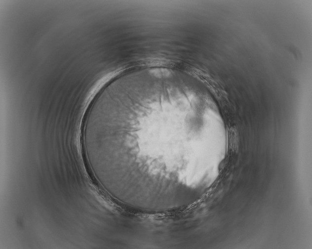 X0000111600147200908131411