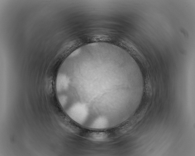 X0000111600169200908131411
