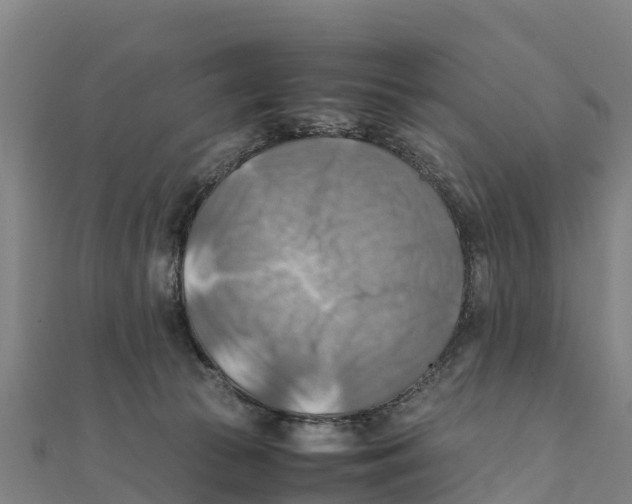 X0000111600177200908131411
