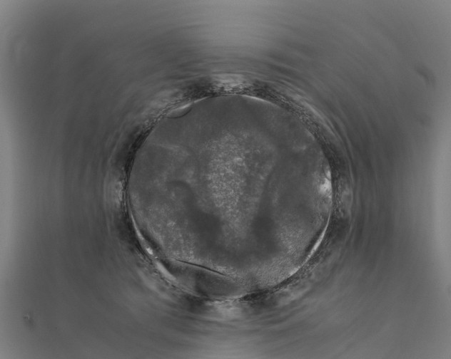 X0000111600417200908131407