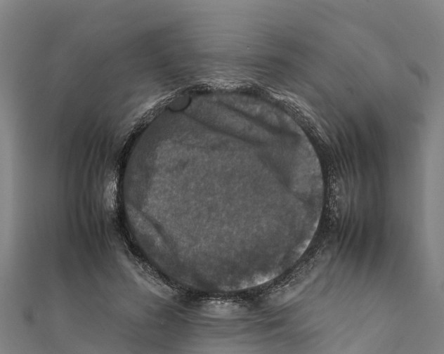 X0000111600596200908131405