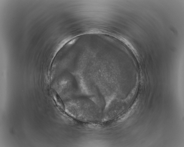 X0000111601097200908131357