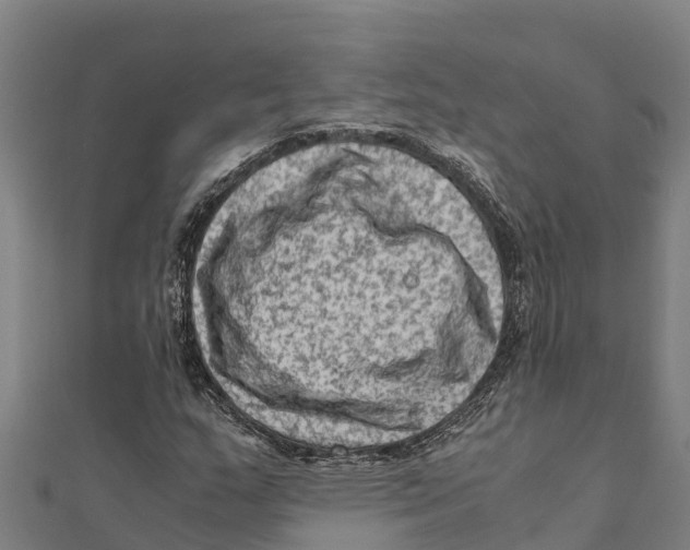 X0000111601159200908131356