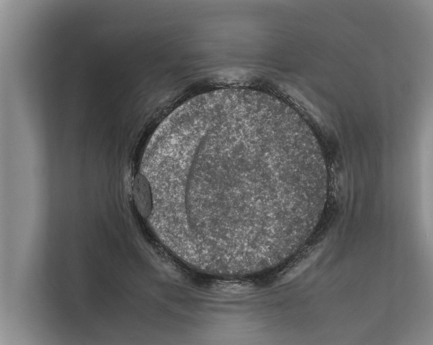 X0000111600597200908271010