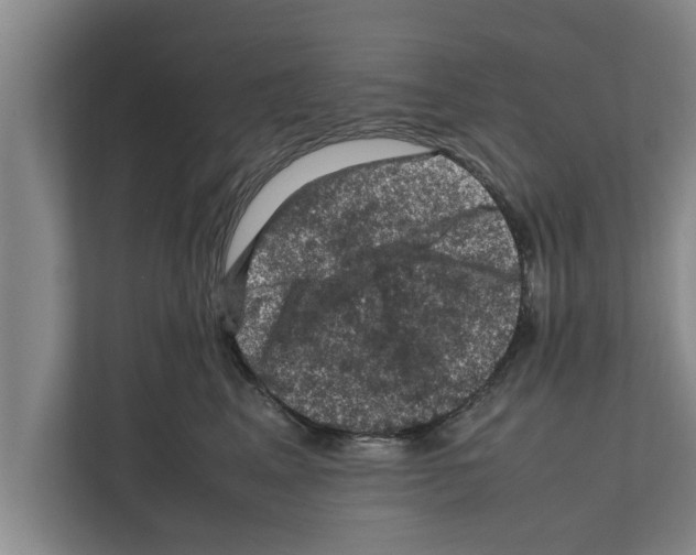 X0000111600617200908271010