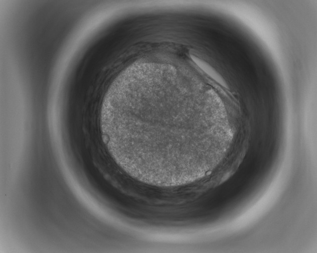 X0000111600766200908271009