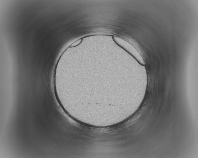 X0000111601387200908271000