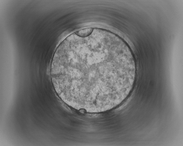 X0000111601529200908270958