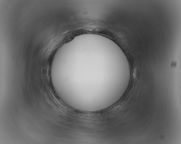 X0000111611396200907171028