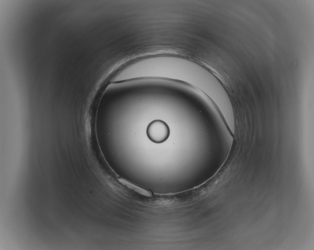 X0000111610350200907241014