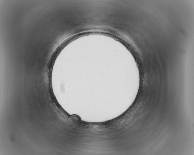 X0000111611360200908281041