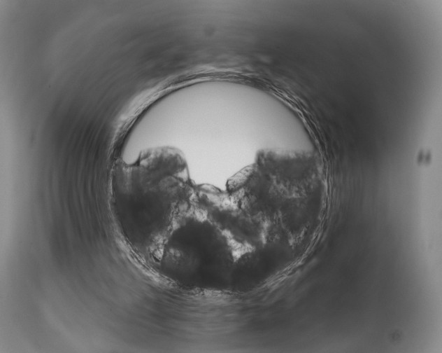 X0000111620149200907171113
