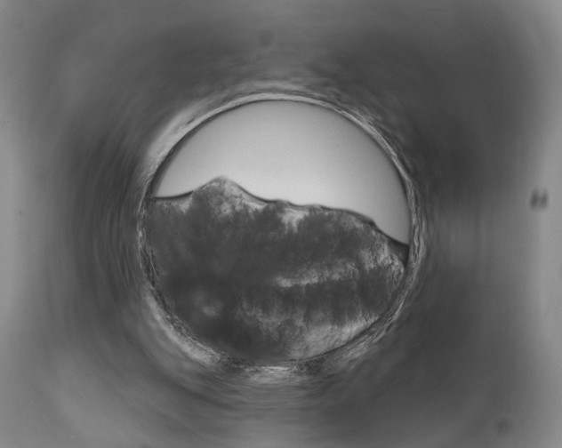 X0000111620151200907171113