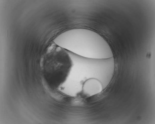 X0000111620175200907171113