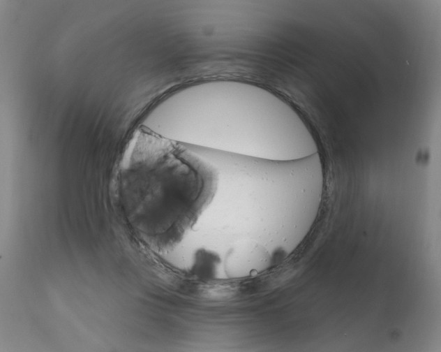 X0000111620359200907171110
