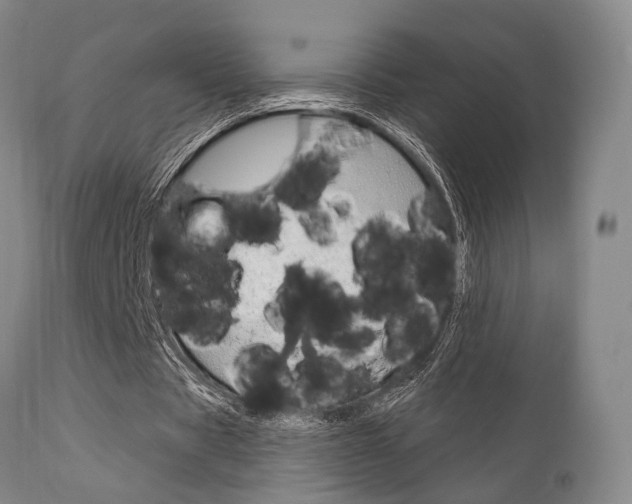 X0000111620529200907171107