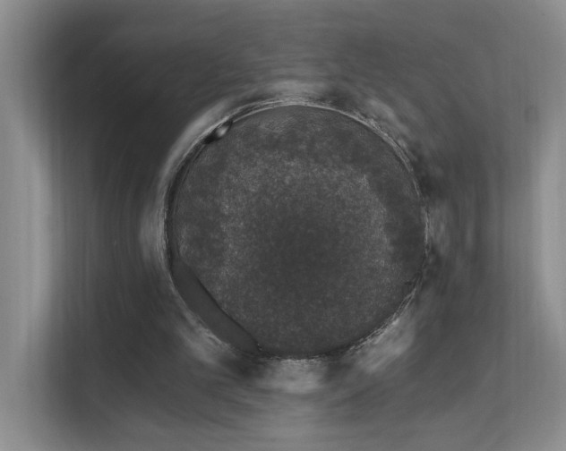 X0000111620101200907171252