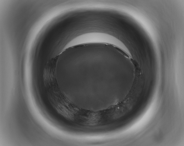 X0000111620143200907171251