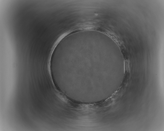 X0000111620147200907171251