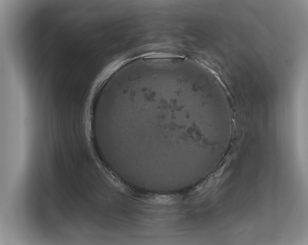 X0000111620149200907171251