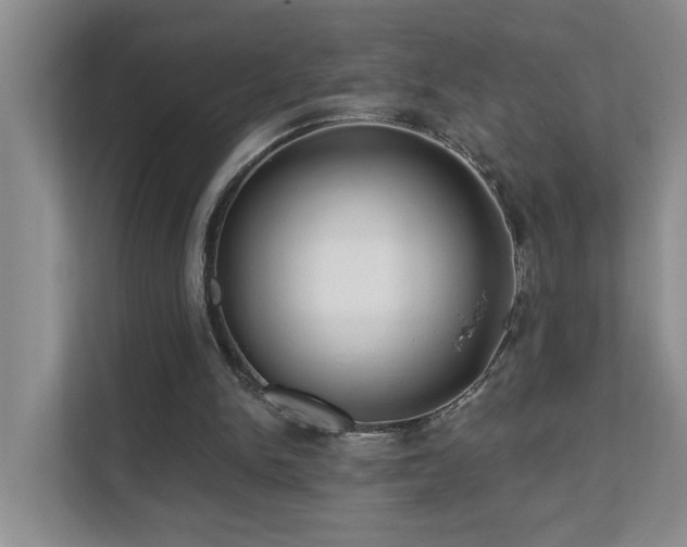X0000111620150200907171251