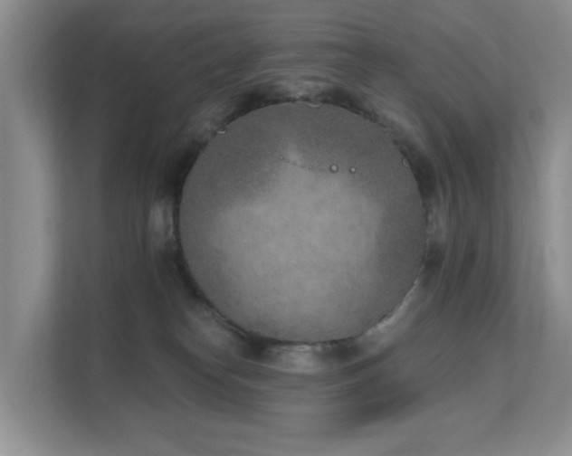 X0000111620182200907171251